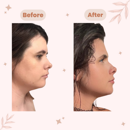 Viva's Face Sculpting Strap